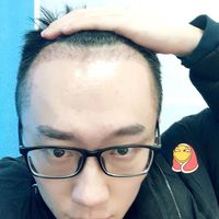 發(fā)際線用戶(hù)圖片