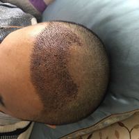 發(fā)際線用戶(hù)圖片