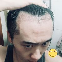 發(fā)際線用戶(hù)圖片
