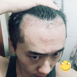 发际线分享社区