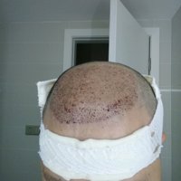 發(fā)際線用戶(hù)圖片