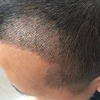 發(fā)際線用戶(hù)圖片