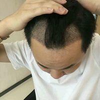 發(fā)際線用戶(hù)圖片