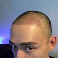 發(fā)際線用戶圖片