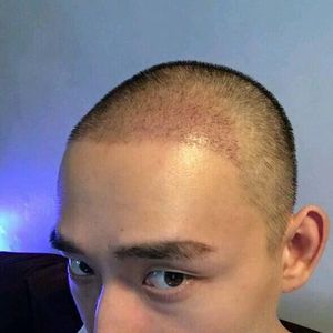 发际线分享社区