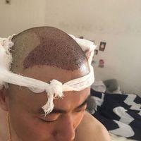 發(fā)際線用戶圖片