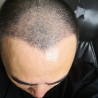 發(fā)際線用戶圖片