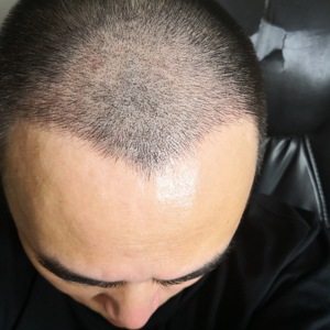发际线分享社区