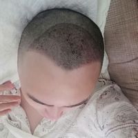 發(fā)際線用戶圖片