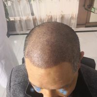發(fā)際線用戶圖片