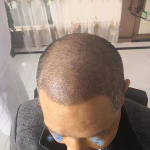 发际线分享社区