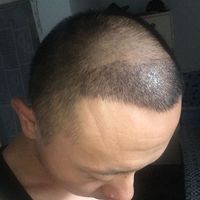 發(fā)際線用戶圖片
