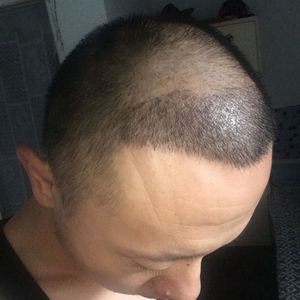 发际线分享社区