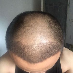 发际线分享社区