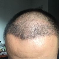 發(fā)際線用戶圖片