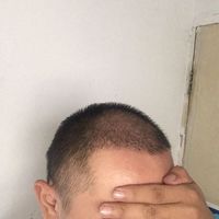 發(fā)際線用戶圖片