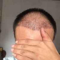 發(fā)際線用戶圖片