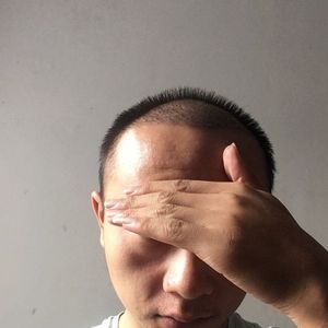 发际线分享社区