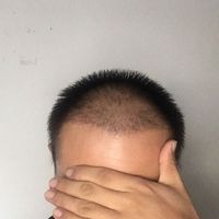 發(fā)際線用戶圖片