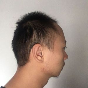 发际线分享社区