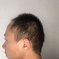 發(fā)際線用戶圖片