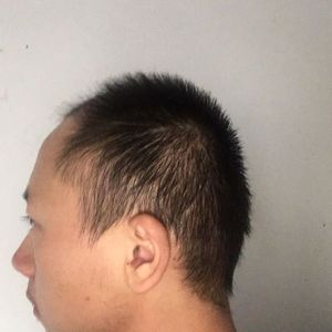 发际线分享社区