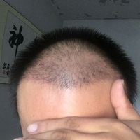 發(fā)際線用戶圖片