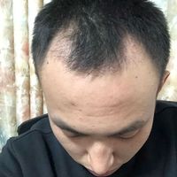 發(fā)際線用戶圖片