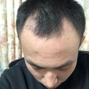 发际线分享社区