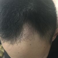 發(fā)際線用戶圖片