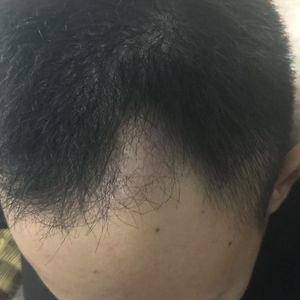 发际线分享社区
