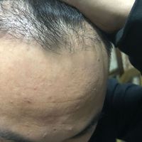 發(fā)際線用戶圖片