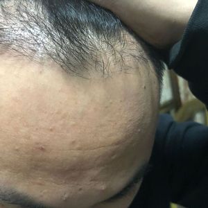 发际线分享社区