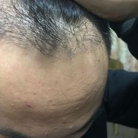 發(fā)際線用戶圖片