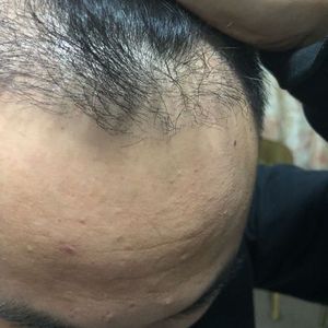 发际线分享社区