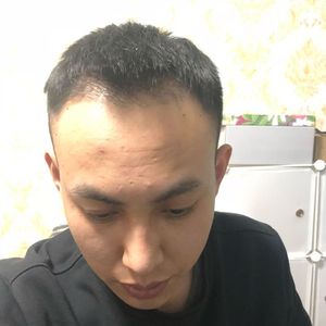 发际线分享社区