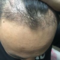 發(fā)際線用戶圖片