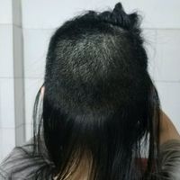發(fā)際線用戶圖片