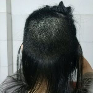 发际线分享社区