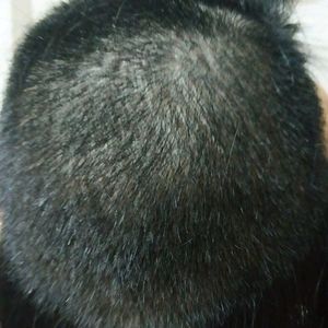 发际线分享社区