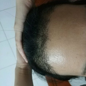 发际线分享社区