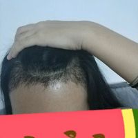 發(fā)際線用戶圖片