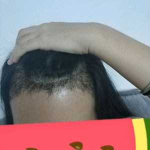 发际线分享社区