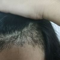 發(fā)際線用戶圖片