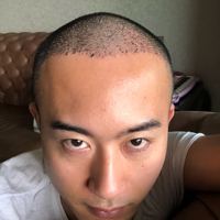 發(fā)際線用戶圖片
