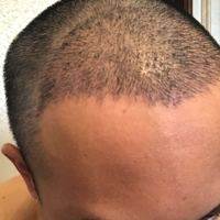 發(fā)際線用戶圖片