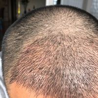 發(fā)際線用戶圖片