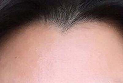 美人尖好看吗 美人尖的优点和缺点分别是什么 求发网 美人尖好看吗 美人尖的优点和缺点分别是什么 求发网