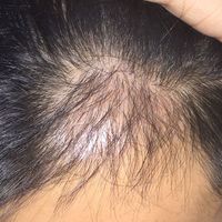 發(fā)際線用戶圖片