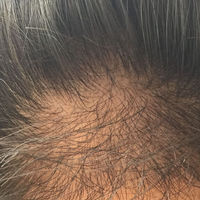 發(fā)際線用戶圖片